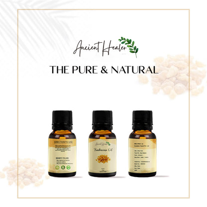 Frankincense Oils
